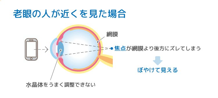 コンタクト すると 近く が 見え ない