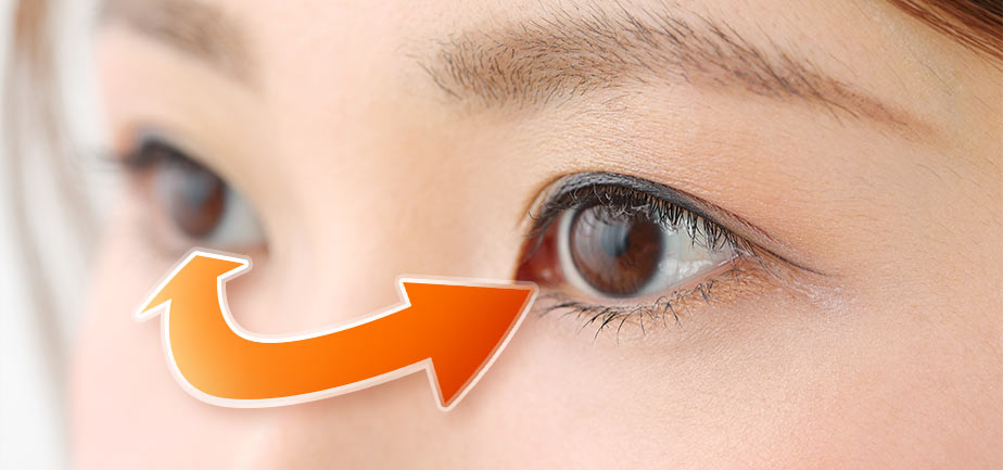 コンタクトレンズを左右逆に付けたらどうなる?の画像