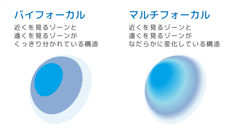 「バイフォーカル」と「マルチフォーカル」