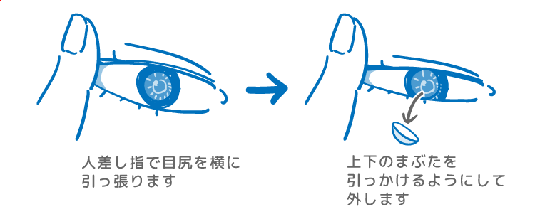 コンタクトつけた目の目尻を横に引っ張り、そのまままばたきをすることでレンズを外しているイラスト 人差し指で目尻を横に引っ張ります→上下のまぶたを引っかけるようにして外します