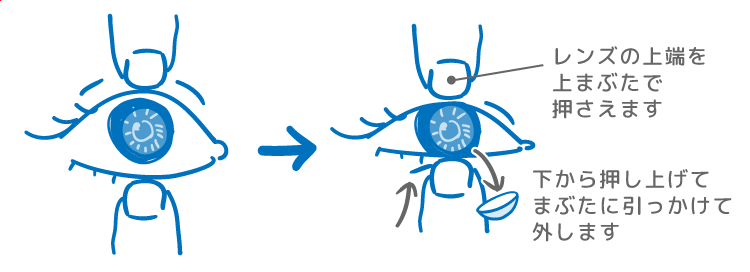 両手の指でまぶたを上下に開き、上まぶたを押さえ、下まぶたを押し上げることでレンズを外しているイラスト レンズの上端を上まぶたで押さえます 下まぶたを下から押し上げてまぶたに引っかけて外します