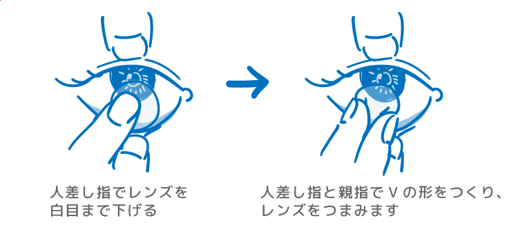 コンタクトを黒目から下の白目にずらした後に、人差し指と親指でレンズをつまみとっているイラスト 人差し指でレンズを白目まで下げる→人差し指を親指でVの形をつくり、レンズをつまみます